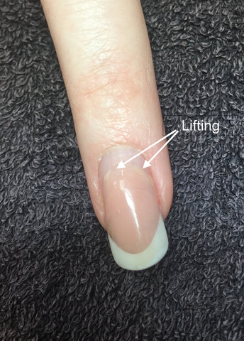 Lifting demonstrated by the product coming away from the cuticle zone