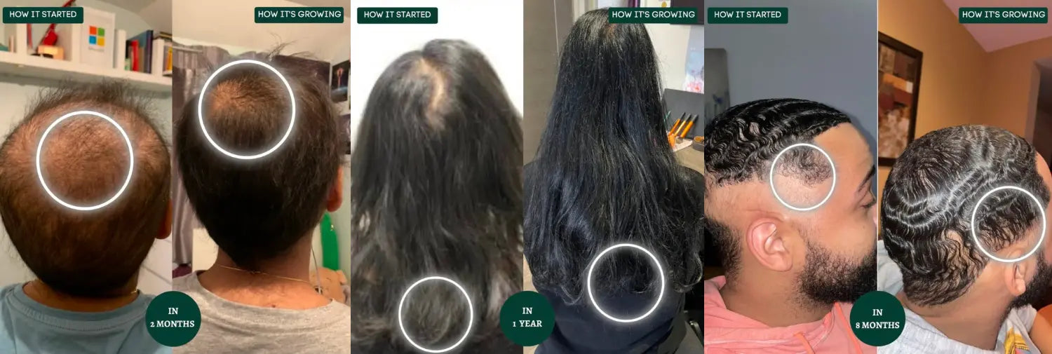 3 before and afters of plantmade customers