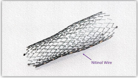 Nitinol