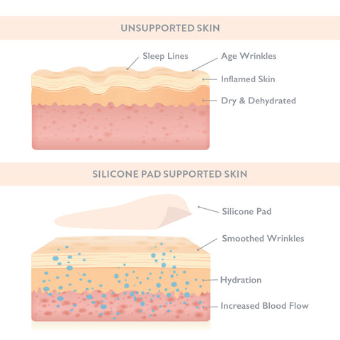 Supported Skin Illustration