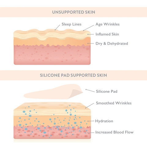 Supported Skin Illustration