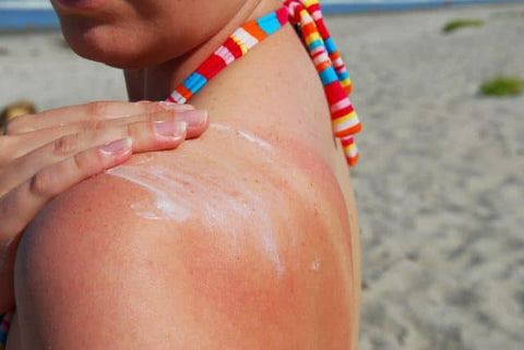 repair after  a sunburn