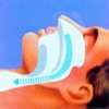 Airway With CPAP