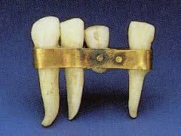 Egyptian teeth