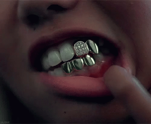 dental jewelry