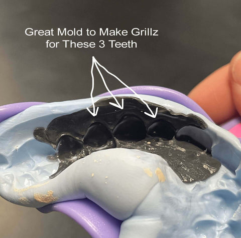 How to Make Grillz Fit Your Teeth: Easy Way To Make Grillz Tighter – Luxe  Grillz