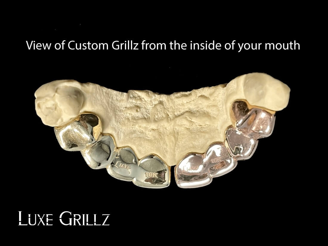 How to Put Grillz On?