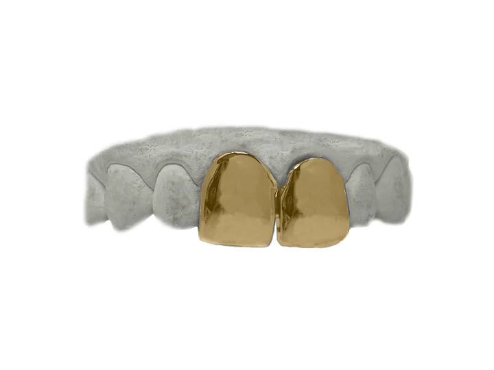 Gold top front 2 teeth grillz