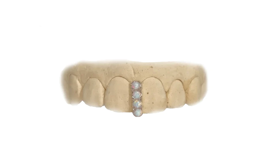 opal gap grillz made of white gold