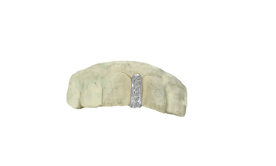 white gold diamond gap grillz