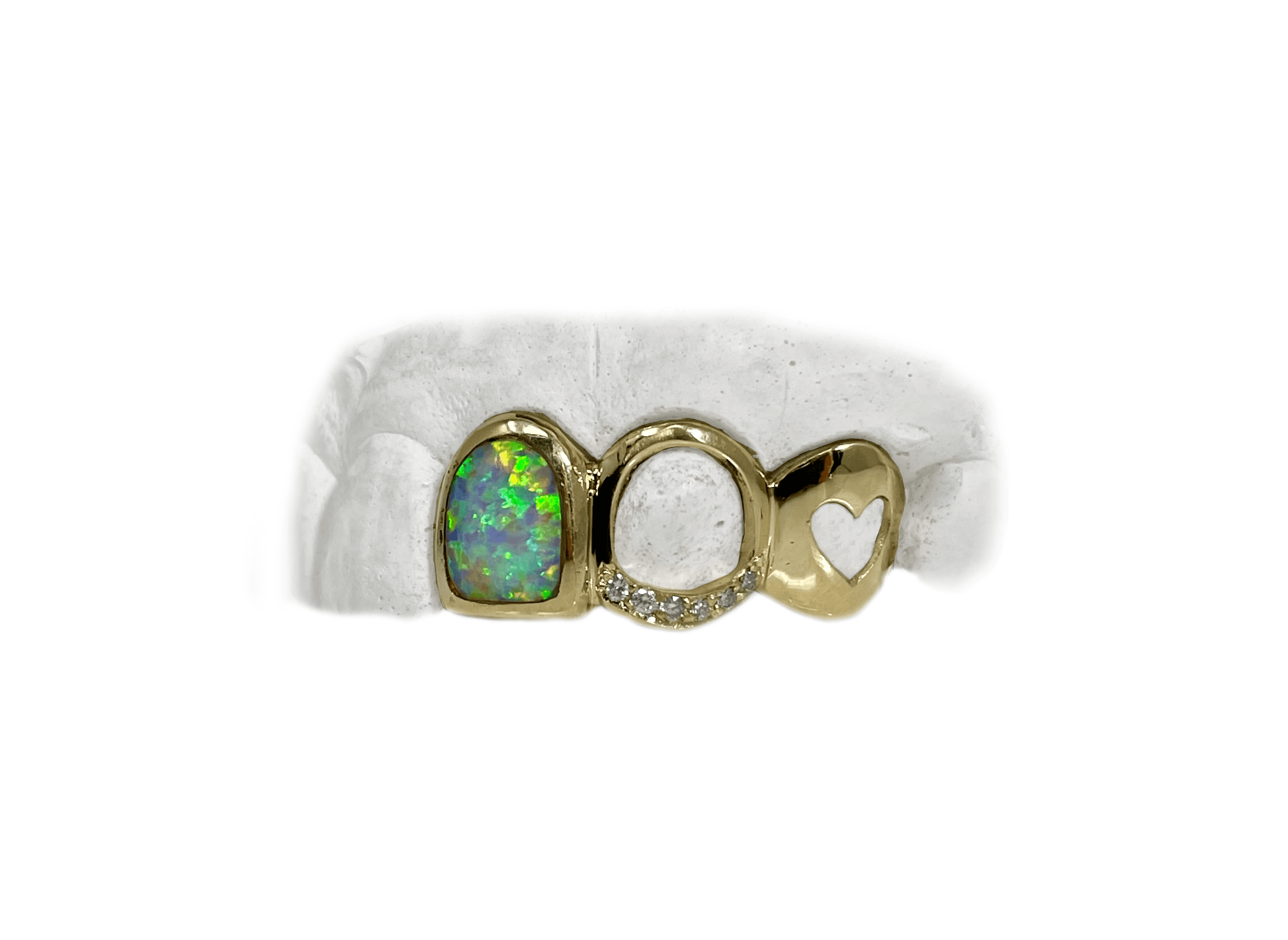 opal grillz