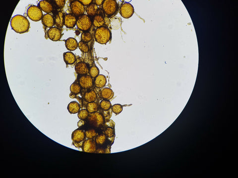 Arbuscule mycchorizae under a microscope