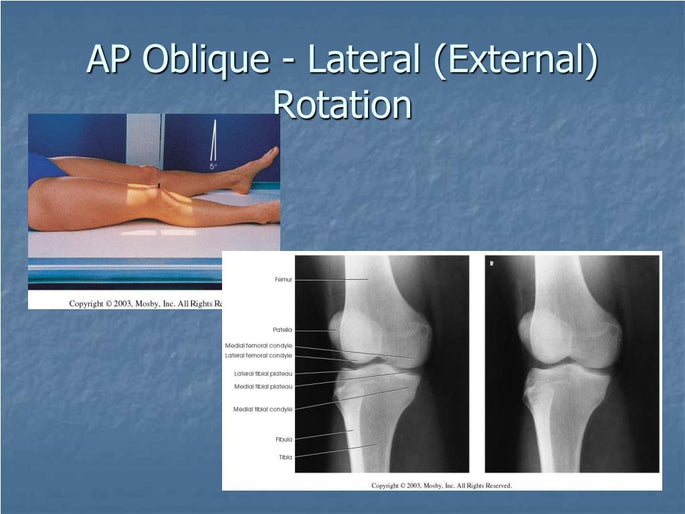 Knee Oblique External X Ray Polymed Lab 6266