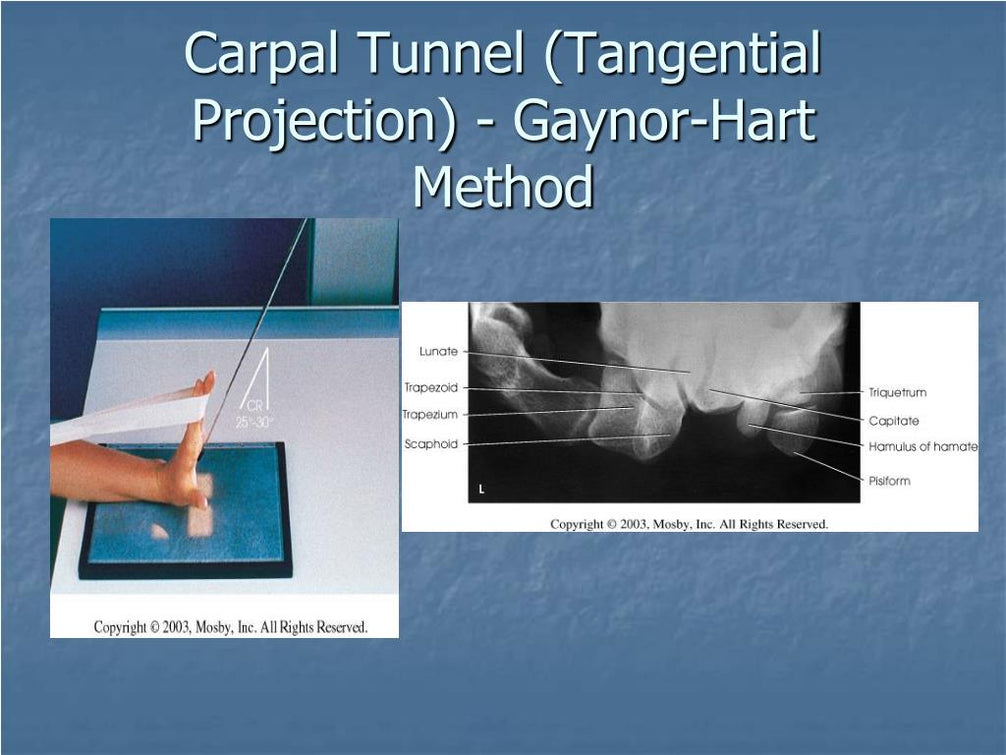 Wrist Carpal Tunnel X Ray Polymed Lab