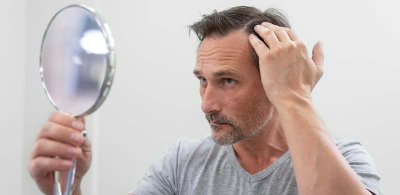 5 consejos para disminuir la caída del pelo