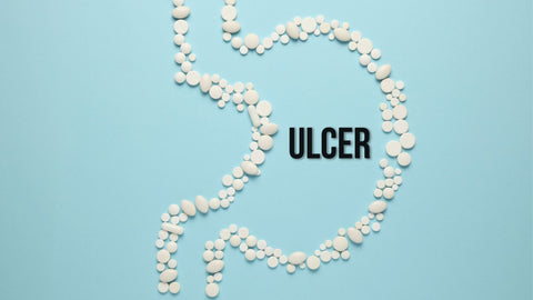 STOMACH ULCER: SYMPTOMS AND SIMPLE HOME REMEDIES TO HEAL