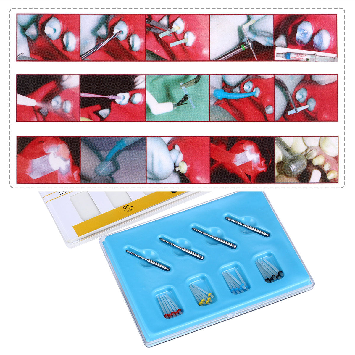 Dental Quartz Fiber Post Teeth Restore 4 pcs drills and 20 pcs fiber posts/Bx