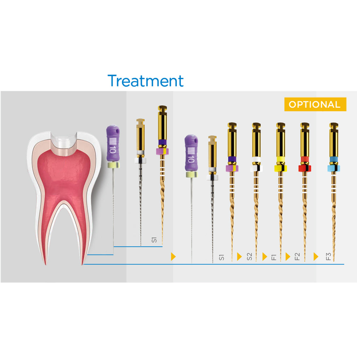 AZDENT Dental NiTi Rotary Engine Files 25mm Assorted SX-F3 Gold Taper 6pcs/Pk - azdentall.com