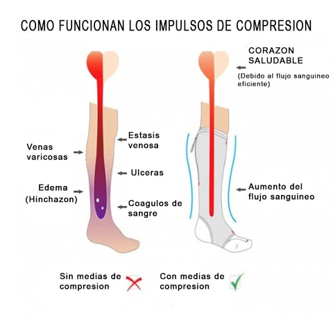 ▷ Beneficios de las medias de compresión para varices