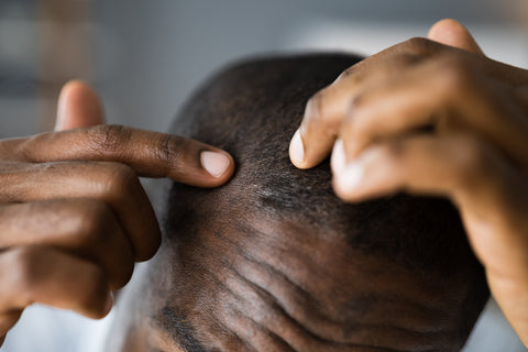 Males Caring For Thin Hair Over 50