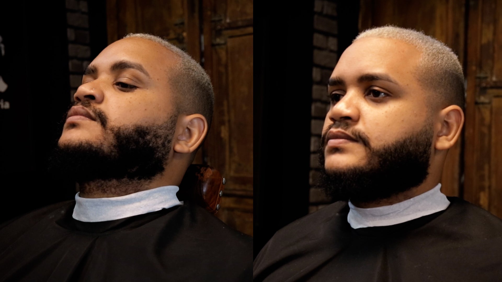 Antes e Depois de uma Camuflagem de Barba Cobrindo Falhas