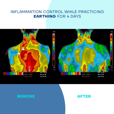 Earthing and Inflammation after 4 days