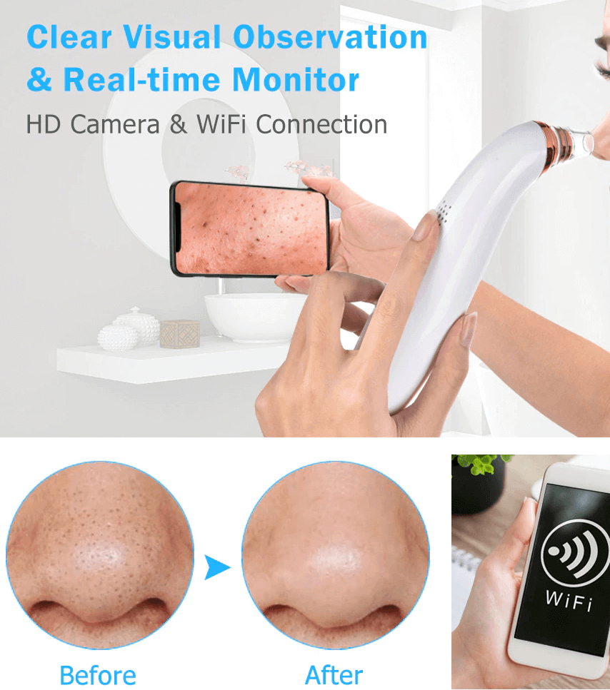 Blackhead Suction Remover