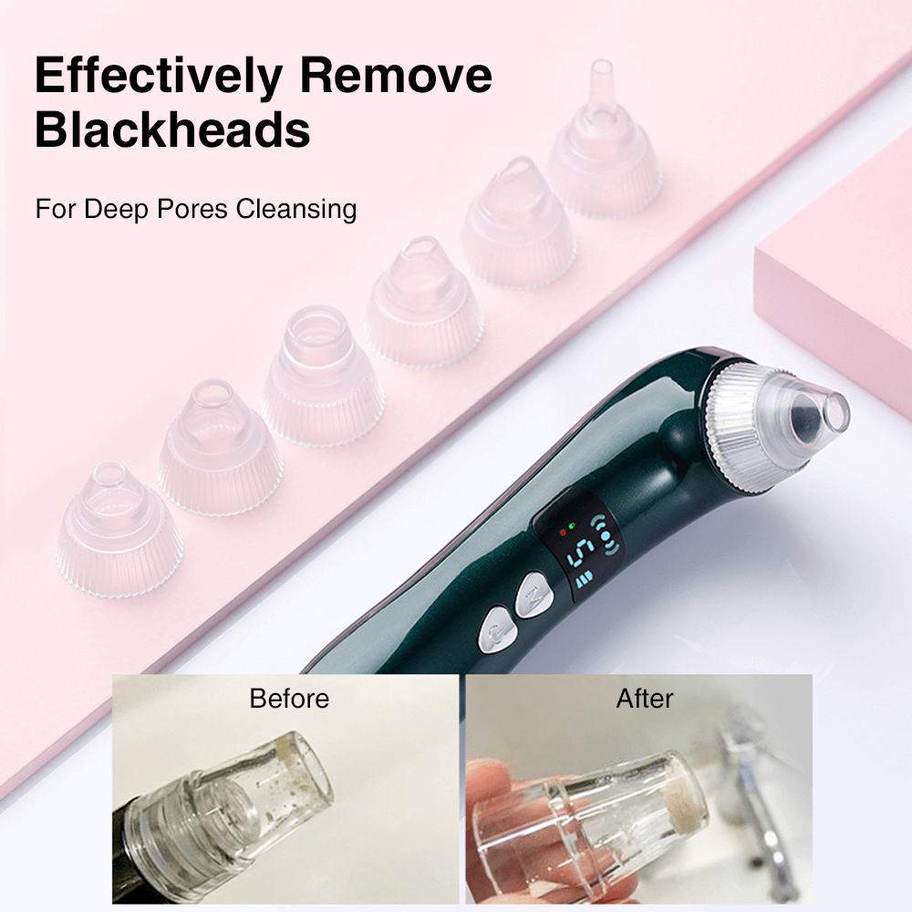 Which Blackhead Remover Is Best
