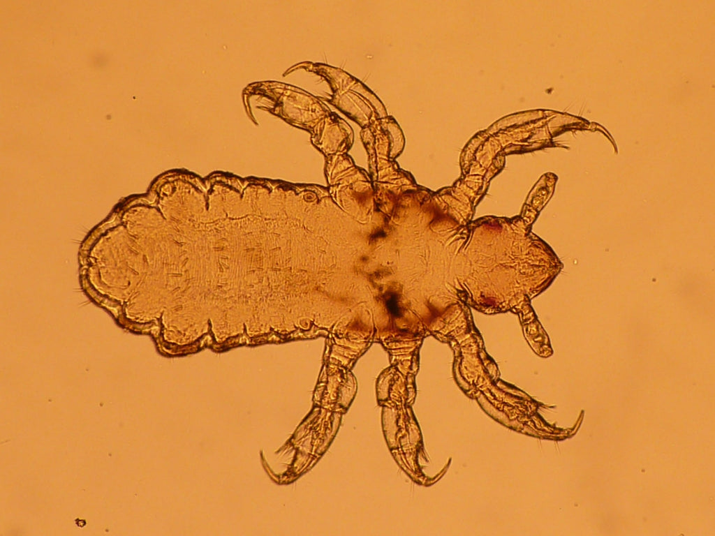 Les poux de tête au microscope