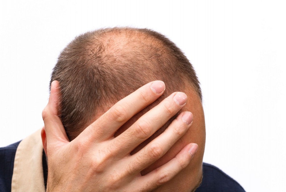Why hairloss happens