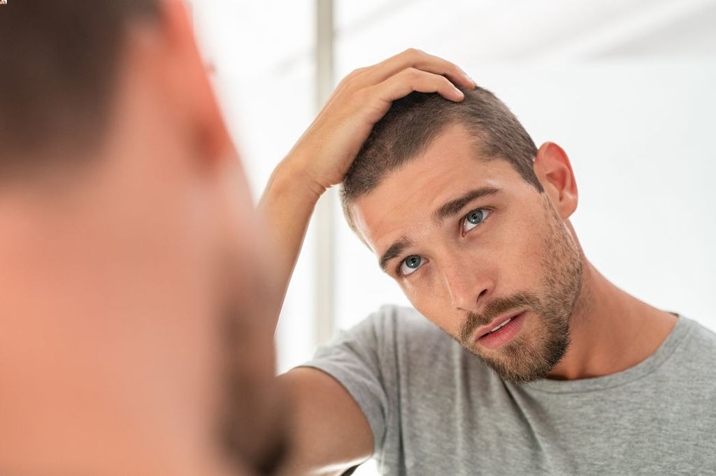 Man looking into mirror and noticing hair loss caused by nutrional deficiencies.