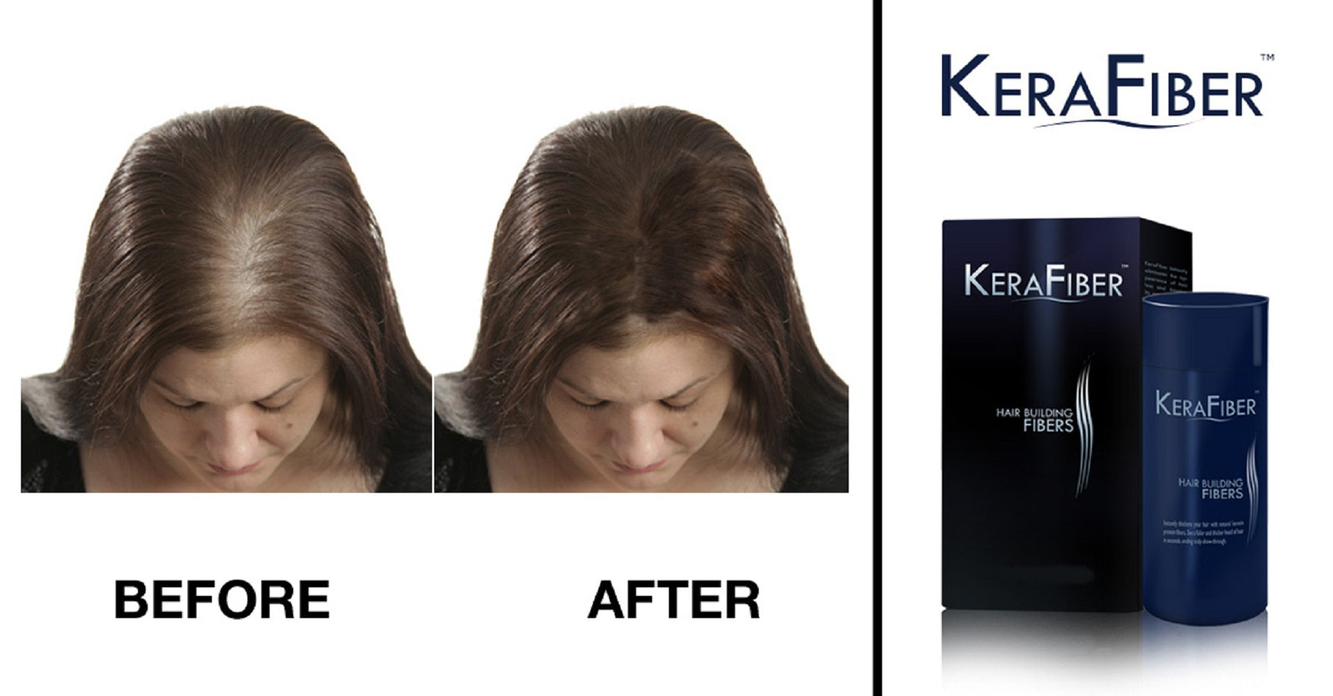 KeraFiber hair building fibers before and after shown on a woman with thinning hair.