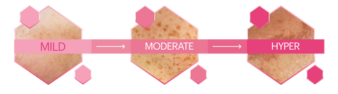 pigmentation scale