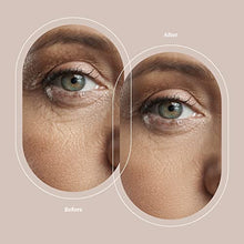 Load image into Gallery viewer, Trophy Skin MicrodermMD - At Home Microdermabrasion Kit - Anti Aging and Acne Treatment - Contains Real Diamond and Pore Extractor Tips to Rejuvenate Skin and Reduce Acne Scars - White
