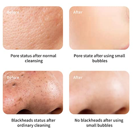 face skin care