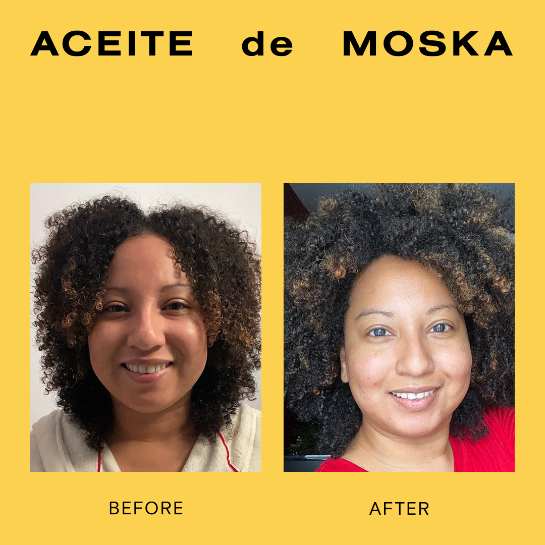 Aceite de Moska for curly hair