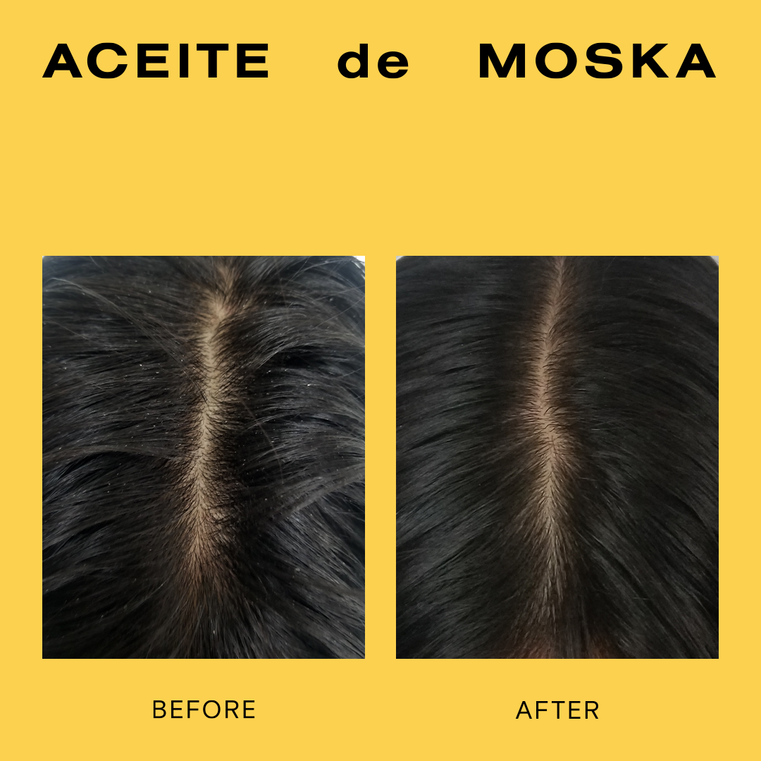Before and after Aceite de Moska