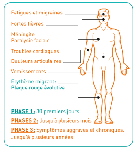 Fatigues, migraines, fortes fièvres, méningite, paralysie faciale, troubles cardiaques, douleurs articulaires, vomissements, érythème migrant (plaque rouge évolutive)