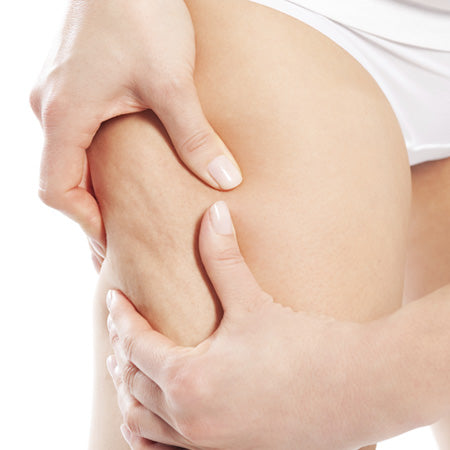 cellulite huile essentielle