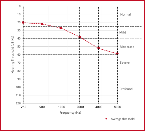 Average audiogram for those aged 60-69 years