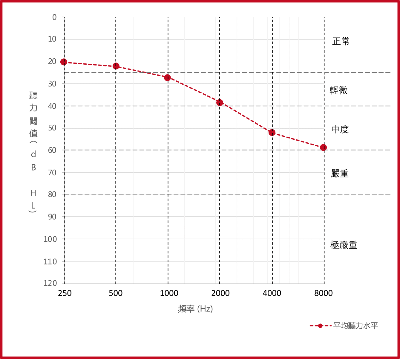 60-69歲的平均聽力圖