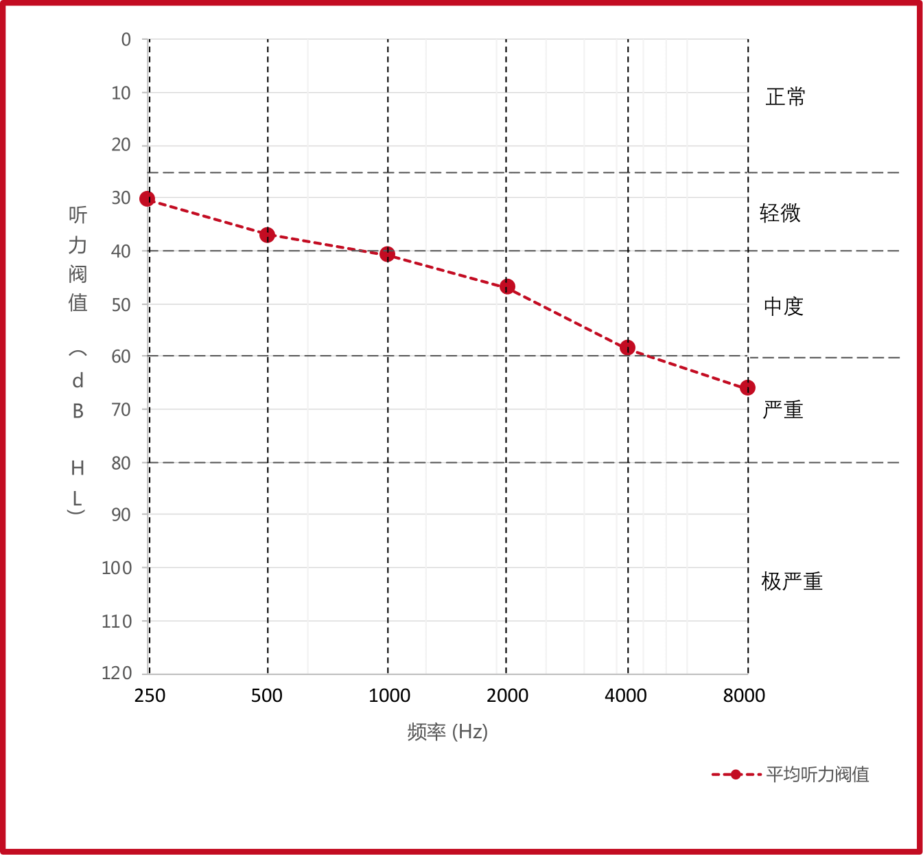 70-79岁的平均听力图 