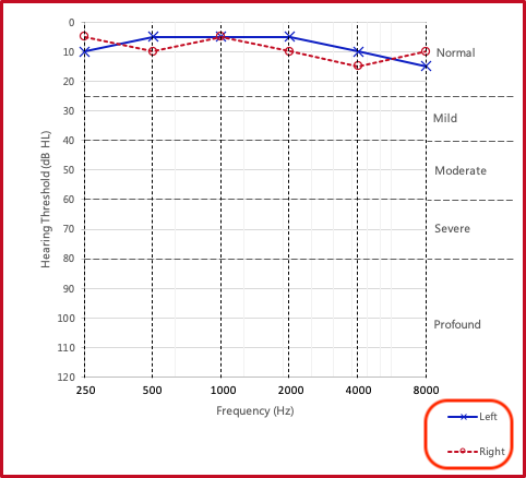 Audiogram symbols key highlighted