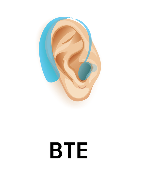 Behind-the-Ear (BTE) hearing aid