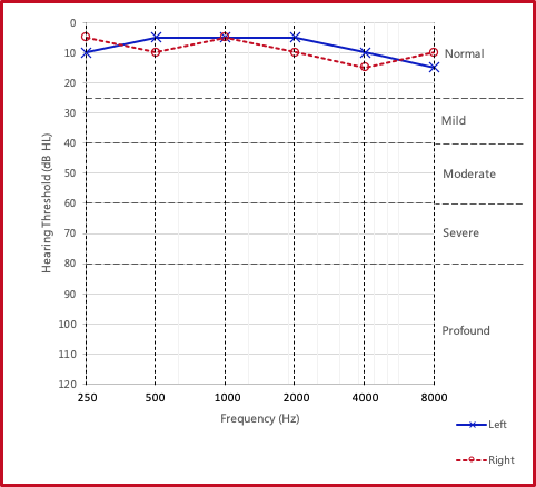 Audiogram example