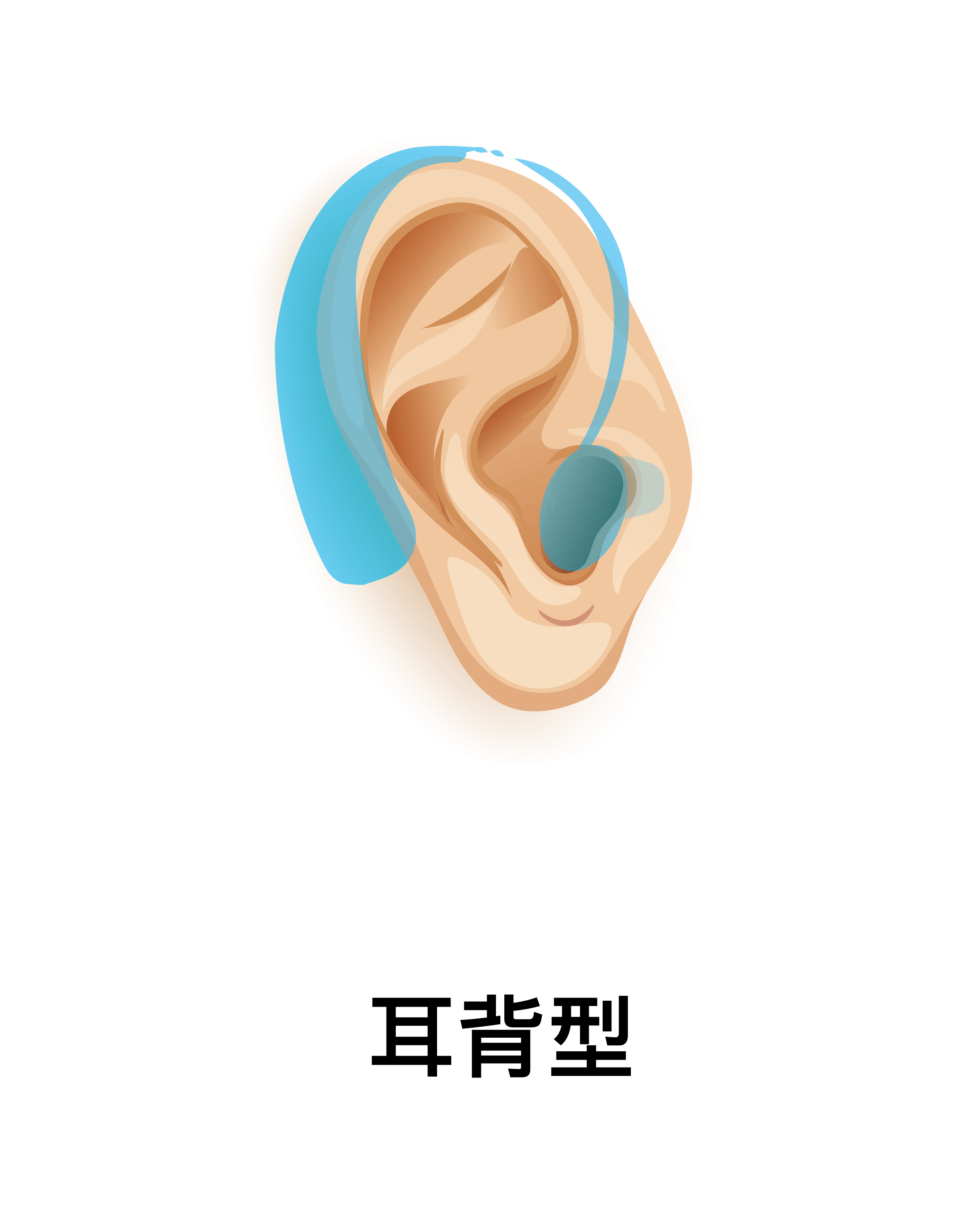 耳背型（BTE）助聽器