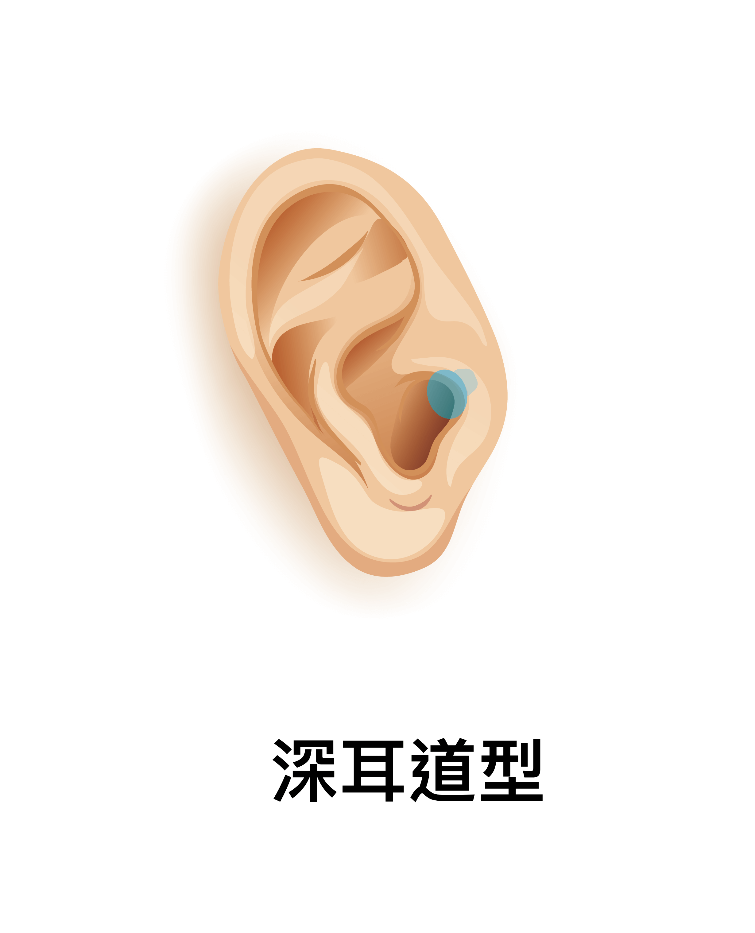 耳道内置接收型（IIC）及 深耳道内置接收型（CIC）助听器