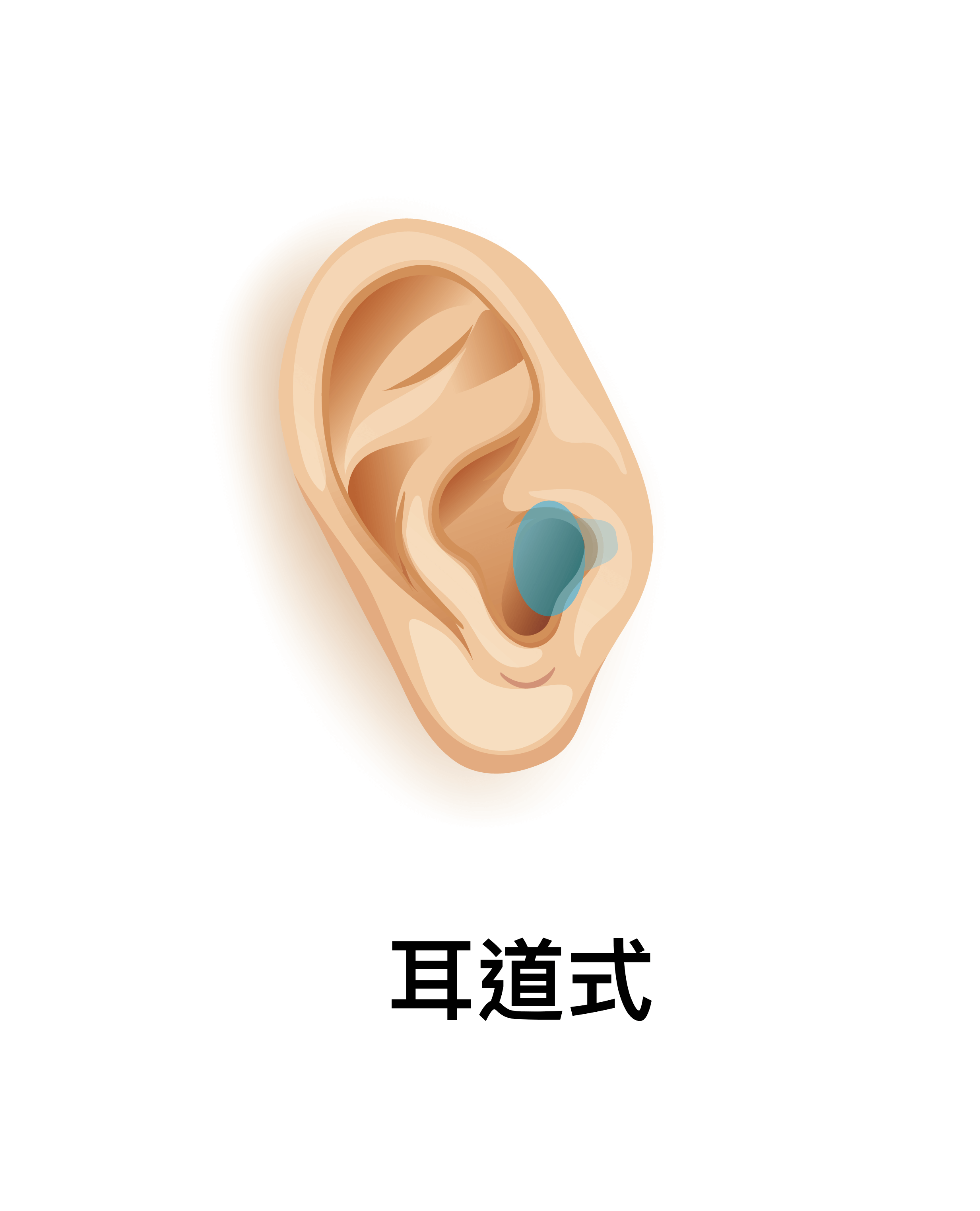 耳道式（ITC) 助听器