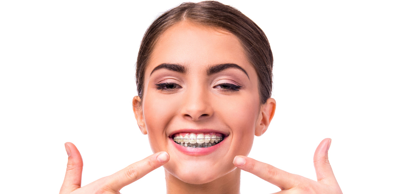 how to whiten yellow teeth with braces