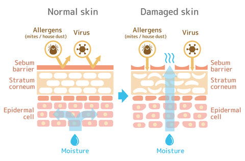 aos Skincare Skin Structure Showing Transepidermal water loss
